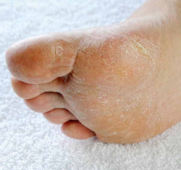 The Foot and Ankle Center of Kirkland | Bunions, Shockwave Therapy and Fungal Nails